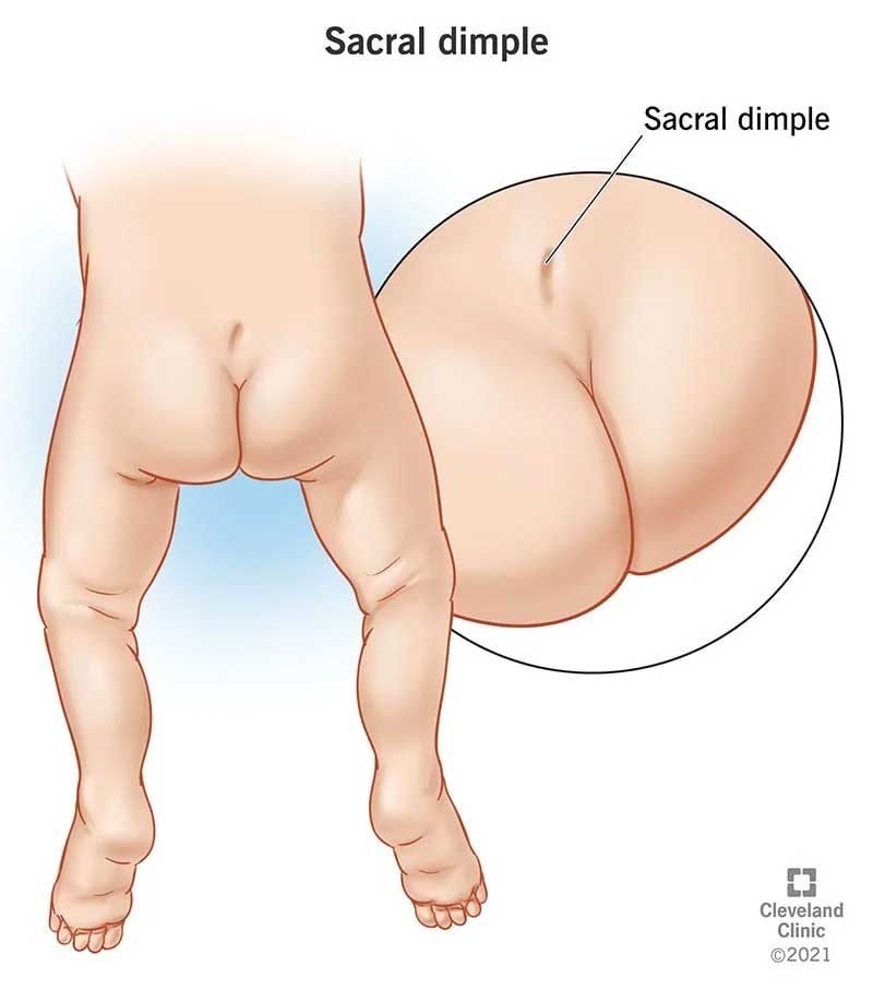 The Secret of Lower Back Dimples: Can You Get Them? 9 sacral-dimple-lower-back-dimples