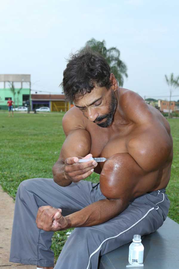 Bodybuilder pumps Synthol into his muscles and now looks like this 4 synthol-abuse-pecs-8