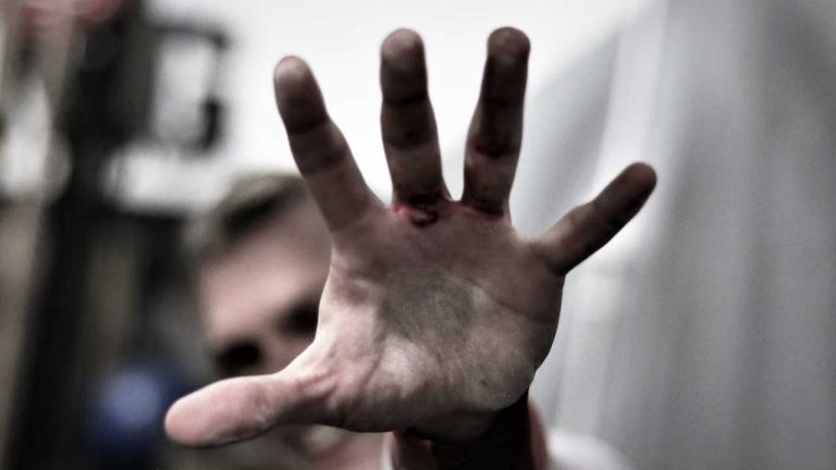 callus-from-weight-lifting